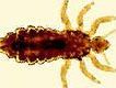 Kopflaus Kopflaus