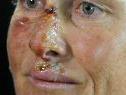 Verletzungen im Gesicht erschweren Schwimmtraining