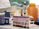 Neue Tests auf CERA und Eigenblutdoping
