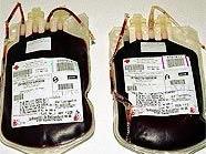 Blutkonserven werden immer benötigt.