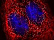 Das HI-Virus in lebender Zelle