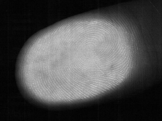 Gerät ermittelt Drogen in Fingerabdruck und könnte zukünftig auf Krebs erkennen
