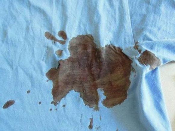 Das T-Shirt des 24-Jährigen war nach der Messerattacke in Währing blutbefleckt Das T-Shirt des 24-Jährigen war nach der Messerattacke in Währing blutbefleckt