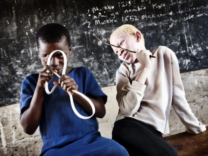 Symbolbild: Das Unicef-Foto des Jahres 2009 zeigt Selina, eine der rund 150.000 Albinos in Tanzania. Symbolbild: Das Unicef-Foto des Jahres 2009 zeigt Selina, eine der rund 150.000 Albinos in Tanzania.
