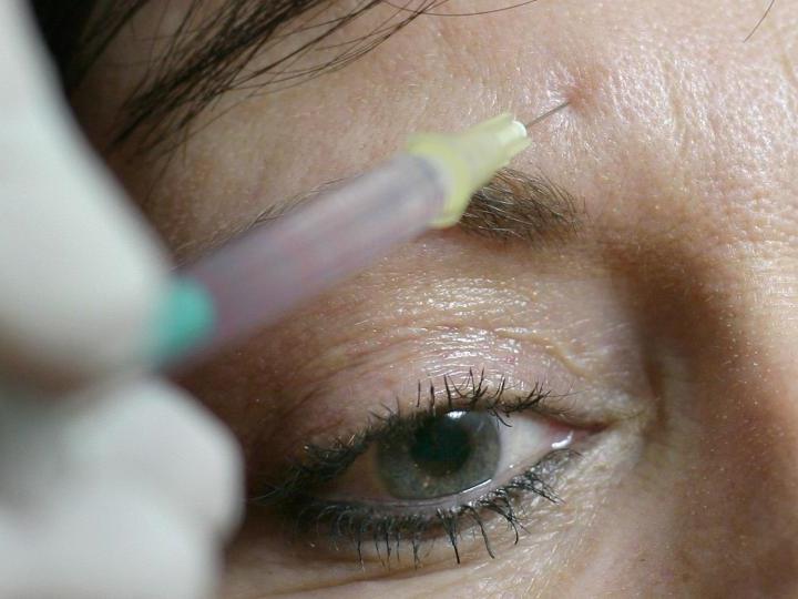 Ein Chirurg drückt einer jungen Frau eine Spritze mit «Botox» an die Stirn