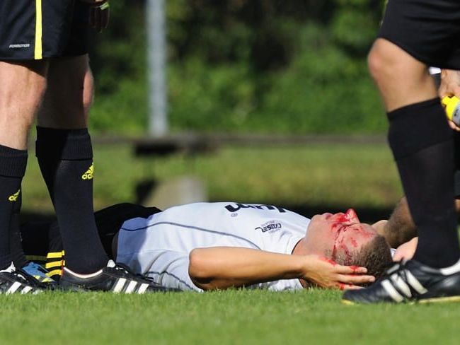 Marcel Wirth verletzte sich schwer und musste ins Spital eingeliefert werden. Marcel Wirth verletzte sich schwer und musste ins Spital eingeliefert werden.