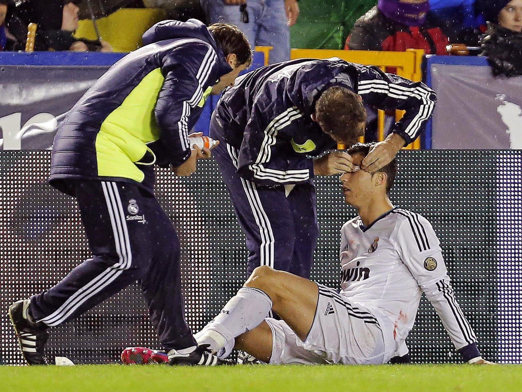 Ronaldo klagte nach Ellbogencheck über Sehstörungen.