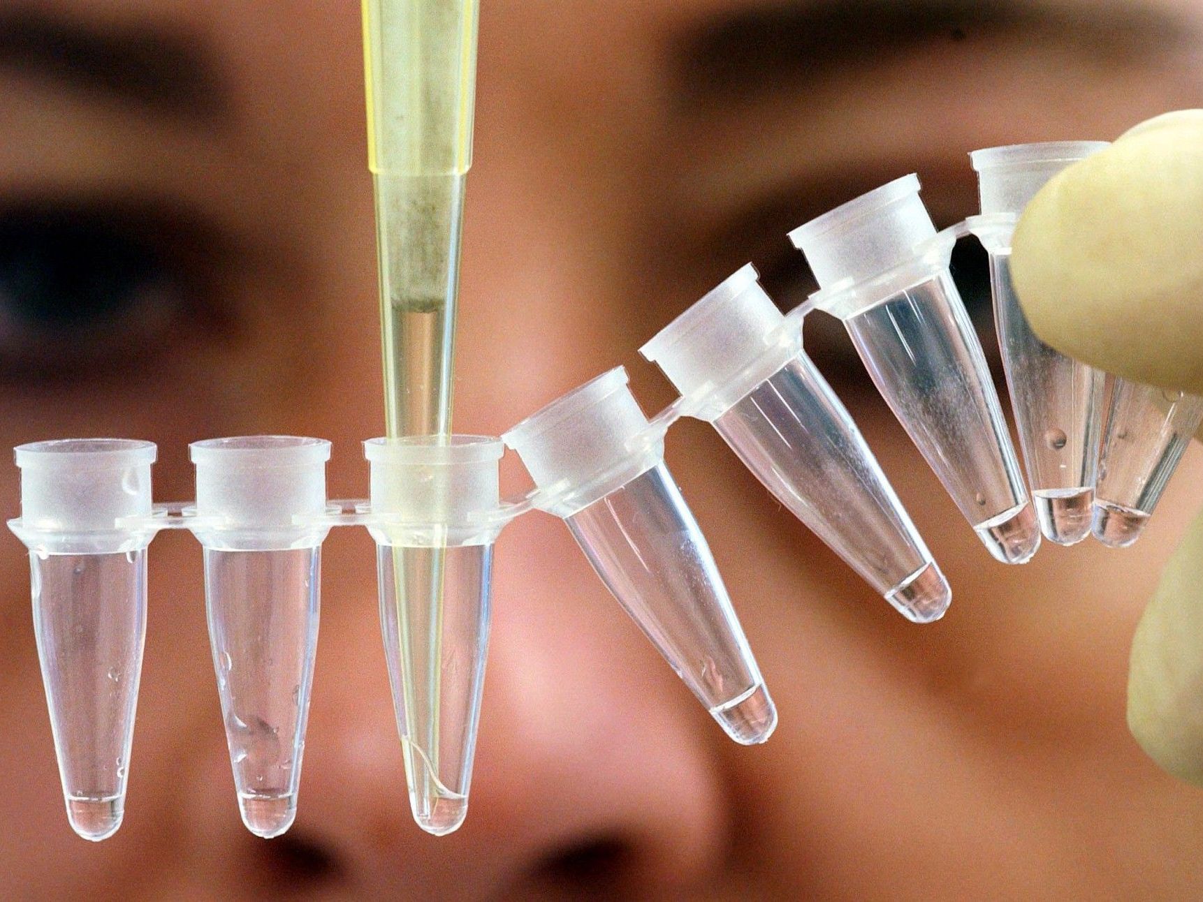 Gene: Mutationen machen nicht unbedingt krank. Gene: Mutationen machen nicht unbedingt krank.