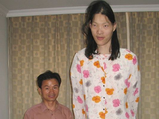 Yao neben ihrem Bruder - ein Hirntumor löste bei ihr ein krankhaftes Wachstum aus. Yao neben ihrem Bruder - ein Hirntumor löste bei ihr ein krankhaftes Wachstum aus.