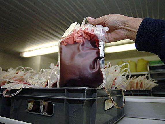 Eine mit HIV-infizierte Blutkonserve wurde einem Patienten verabreicht