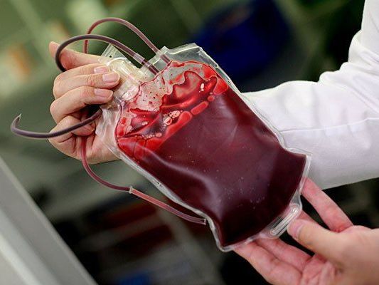 In einem österreichischen Spital wurde einer Person eine HIV-infizierte Blutkonserve verabreicht In einem österreichischen Spital wurde einer Person eine HIV-infizierte Blutkonserve verabreicht