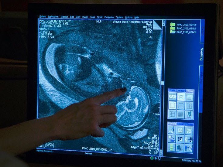 Fötus-Scan: neue Erkenntnisse über Autismus und Schizophrenie erhofft. Fötus-Scan: neue Erkenntnisse über Autismus und Schizophrenie erhofft.