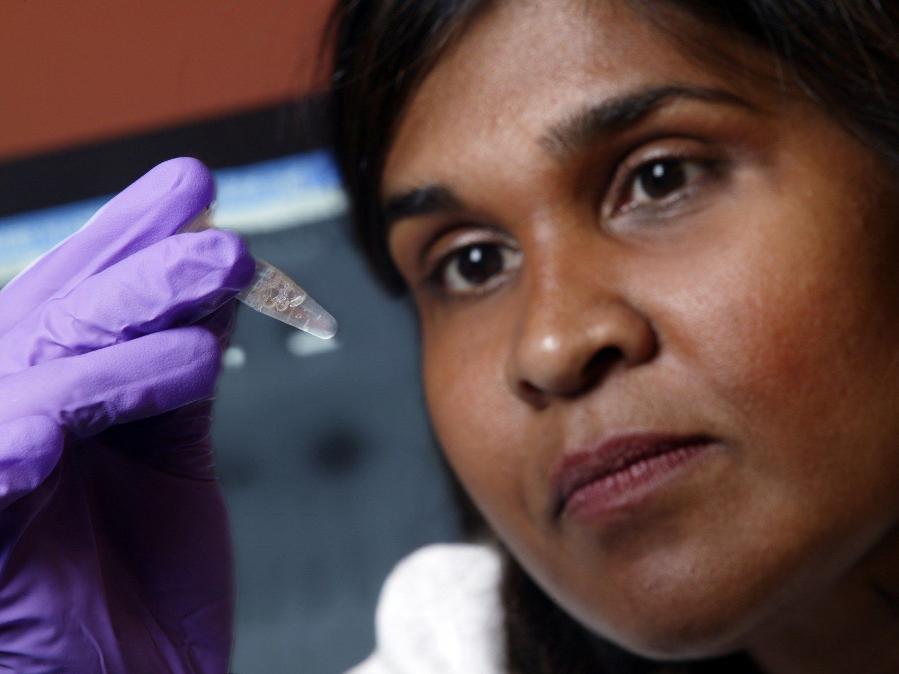 Dr. Deborah Persaud (im Bild): "Dies ist ein Beweis dafür, dass HIV bei Kindern möglicherweise heilbar ist". Dr. Deborah Persaud (im Bild): "Dies ist ein Beweis dafür, dass HIV bei Kindern möglicherweise heilbar ist".