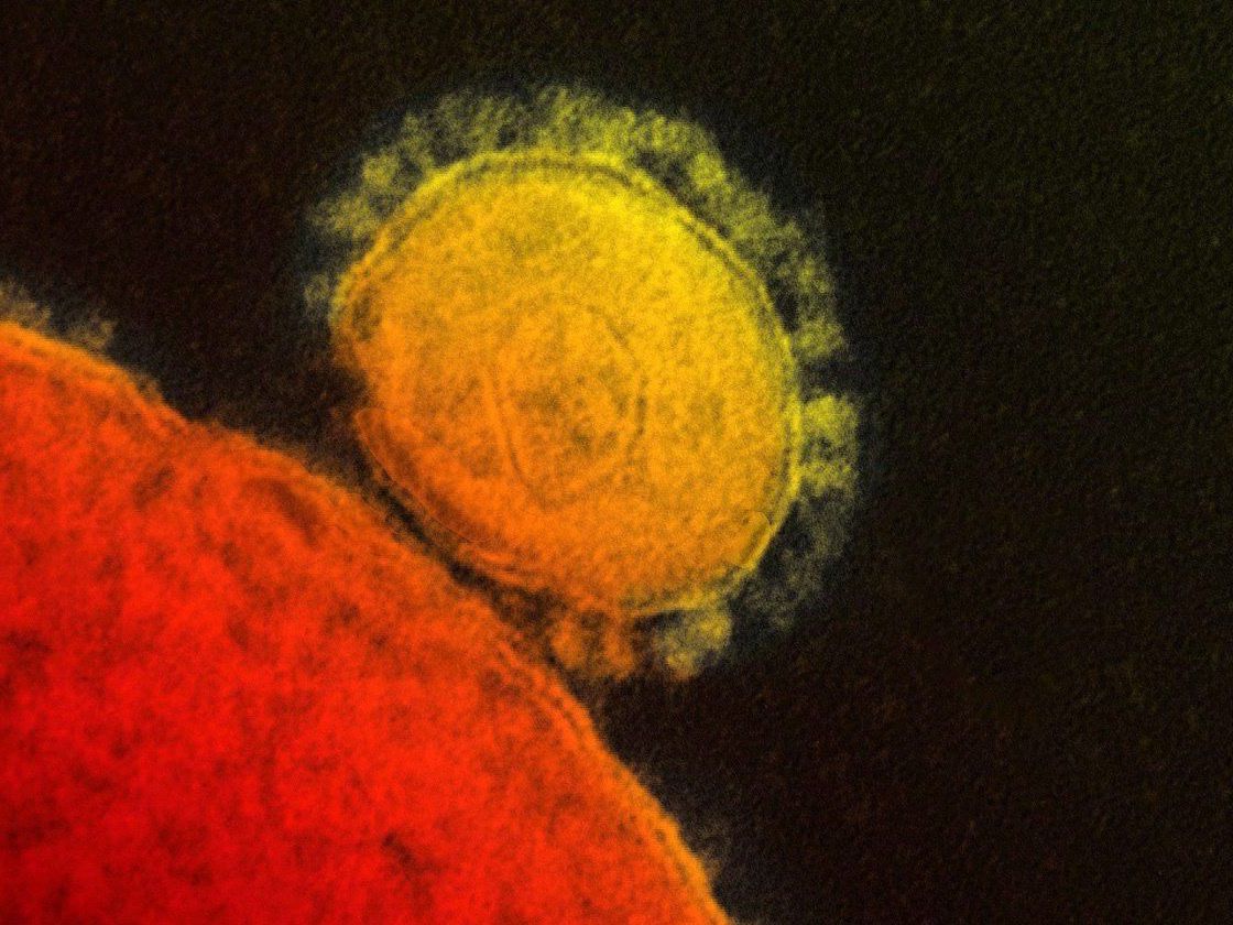 Der neue Coronavirus ist sogar noch tödlicher als SARS, allerdings ist er weniger ansteckend. Der neue Coronavirus ist sogar noch tödlicher als SARS, allerdings ist er weniger ansteckend.