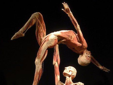 Die "Körperwelten"-Ausstellung wird massiv angegriffen Die "Körperwelten"-Ausstellung wird massiv angegriffen
