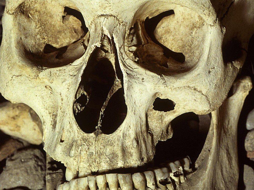 Knochen zu Hause gehortet: Ein Burgenländer wurde nun wegen Störung der Totenruhe angezeigt. Knochen zu Hause gehortet: Ein Burgenländer wurde nun wegen Störung der Totenruhe angezeigt.