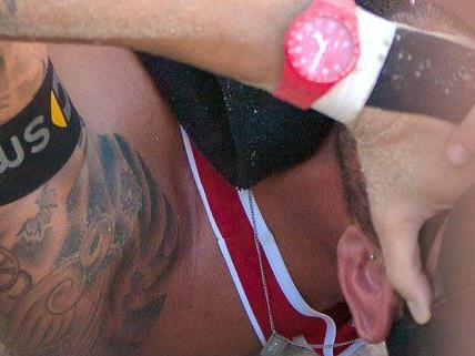 Clemens Doppler (AUT) verletzt sich am Donnerstag, 01. August 2013, während des Spiels gegen Richard Schuil/Reinder Nummerdor (NED) im Rahmen der Beach-Volleyball EM in Klagenfu