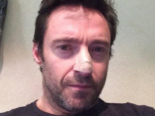 Hugh Jackman mit Pflaster auf Nase - wegen Hautkrebs behandelt
