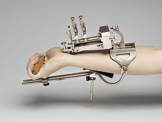 Siphygmograph: Instrument, mit Hilfe dessen sich die Pulsbewegung bleibend in Gestalt einer Kurve darstellen läßt, an welcher man alle Eigentümlichkeiten der Pulsbewegung genau studieren kann Siphygmograph: Instrument, mit Hilfe dessen sich die Pulsbewegung bleibend in Gestalt einer Kurve darstellen läßt, an welcher man alle Eigentümlichkeiten der Pulsbewegung genau studieren kann