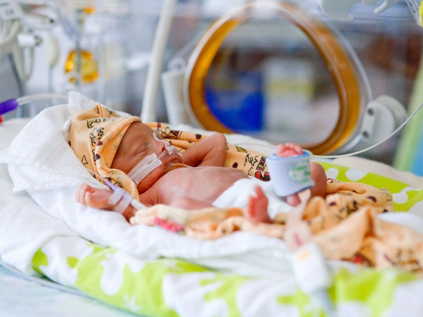 Auch weniger schwere Asthma-Anfälle bei Kindern. Auch weniger schwere Asthma-Anfälle bei Kindern.