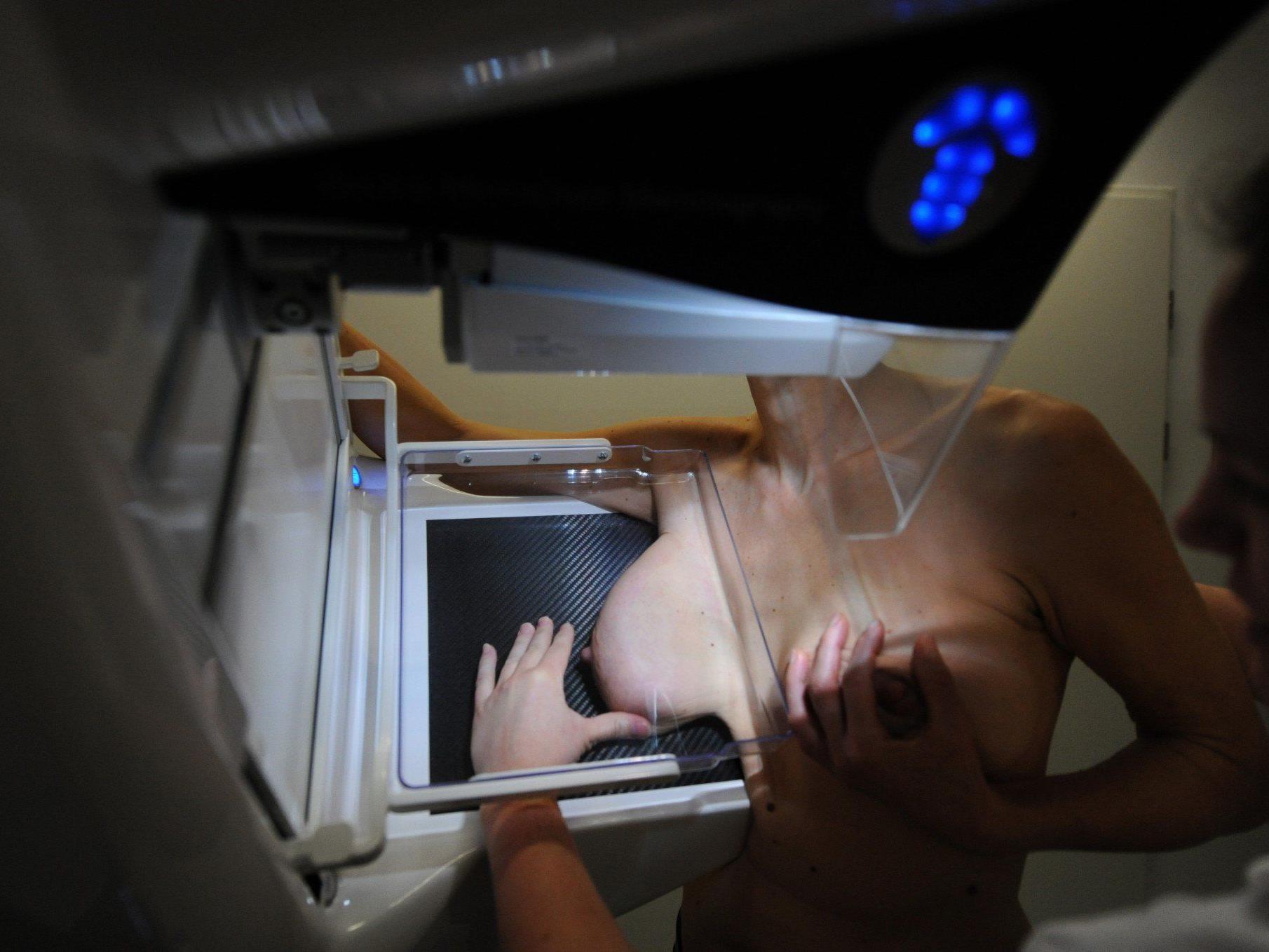 E-Card berechtigt Frauen zwischen 45 und 69 automatisch zur Früherkennungsmammografie