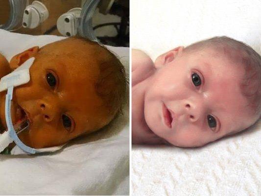 Die kleine Sophia auf dem Originalfoto (l.) und auf dem retuschierten Babyfoto.