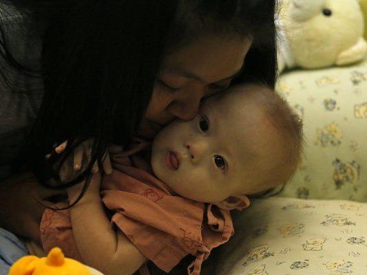 Baby Gammy wurde in Thailand von einer Leihmutter auf die Welt gebracht