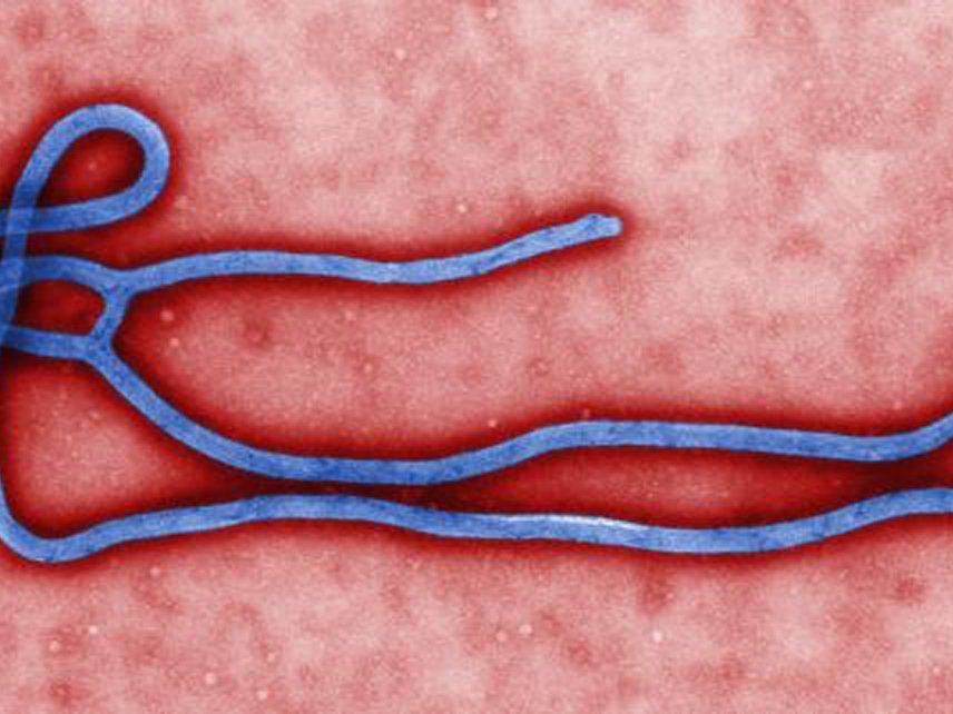 Das Ebola-Virus wird über direkten Kontakt mit Blut oder Körperflüssigkeiten (Speichel, Urin) von Infizierten übertragen. Das Ebola-Virus wird über direkten Kontakt mit Blut oder Körperflüssigkeiten (Speichel, Urin) von Infizierten übertragen.