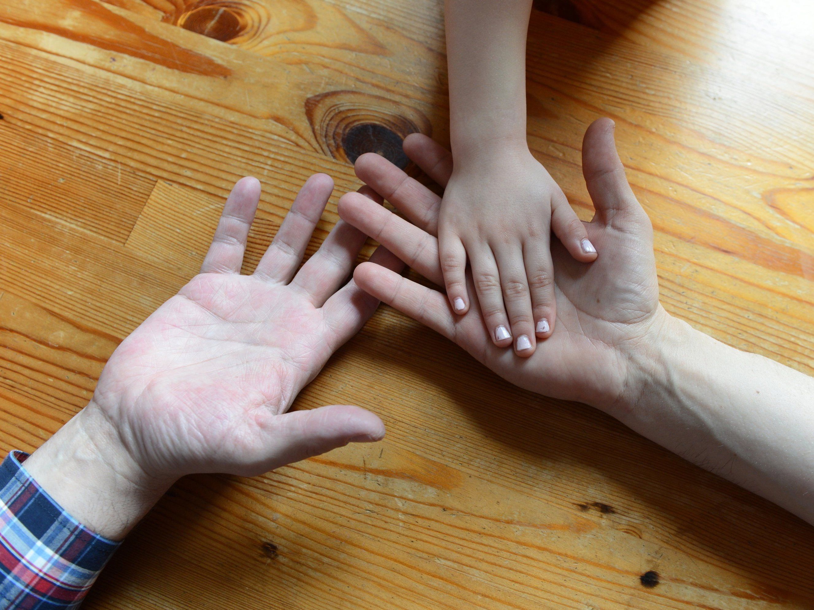 Homosexualität: Adoptionsverbot verfassungswidrig Homosexualität: Adoptionsverbot verfassungswidrig
