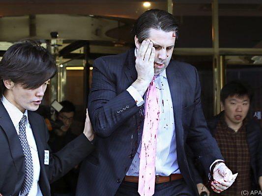 US-Botschafter Lippert wurde im Gesicht verletzt