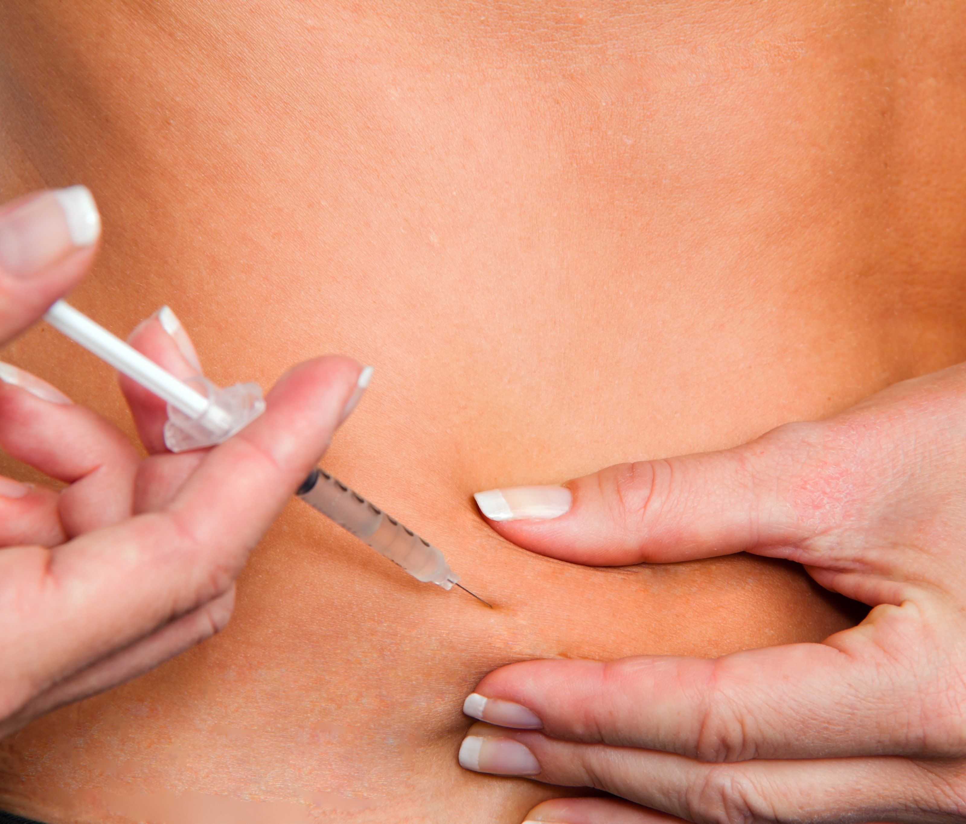 Frauen mit Typ-2-Diabetes erleiden häufiger Herzinfarkt oder Schlaganfall. Frauen mit Typ-2-Diabetes erleiden häufiger Herzinfarkt oder Schlaganfall.