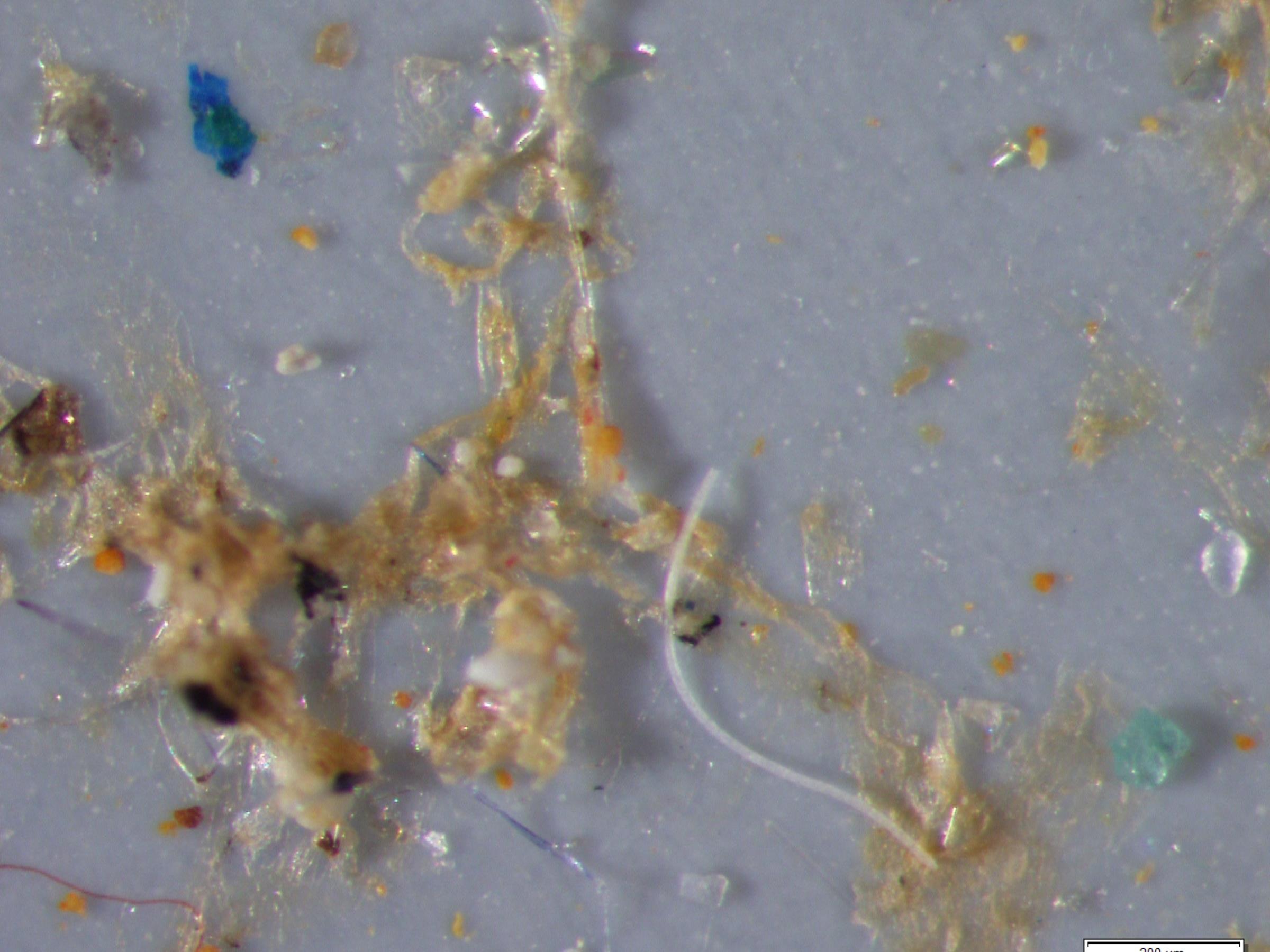 Mikroplastikpartikel in Speisefischen und Pflanzenfressern nachgewiesen