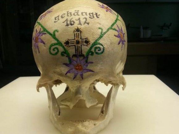 Dieser Schädelknochen wurde in der Wiese in dem Spital in Ottakring gefunden Dieser Schädelknochen wurde in der Wiese in dem Spital in Ottakring gefunden