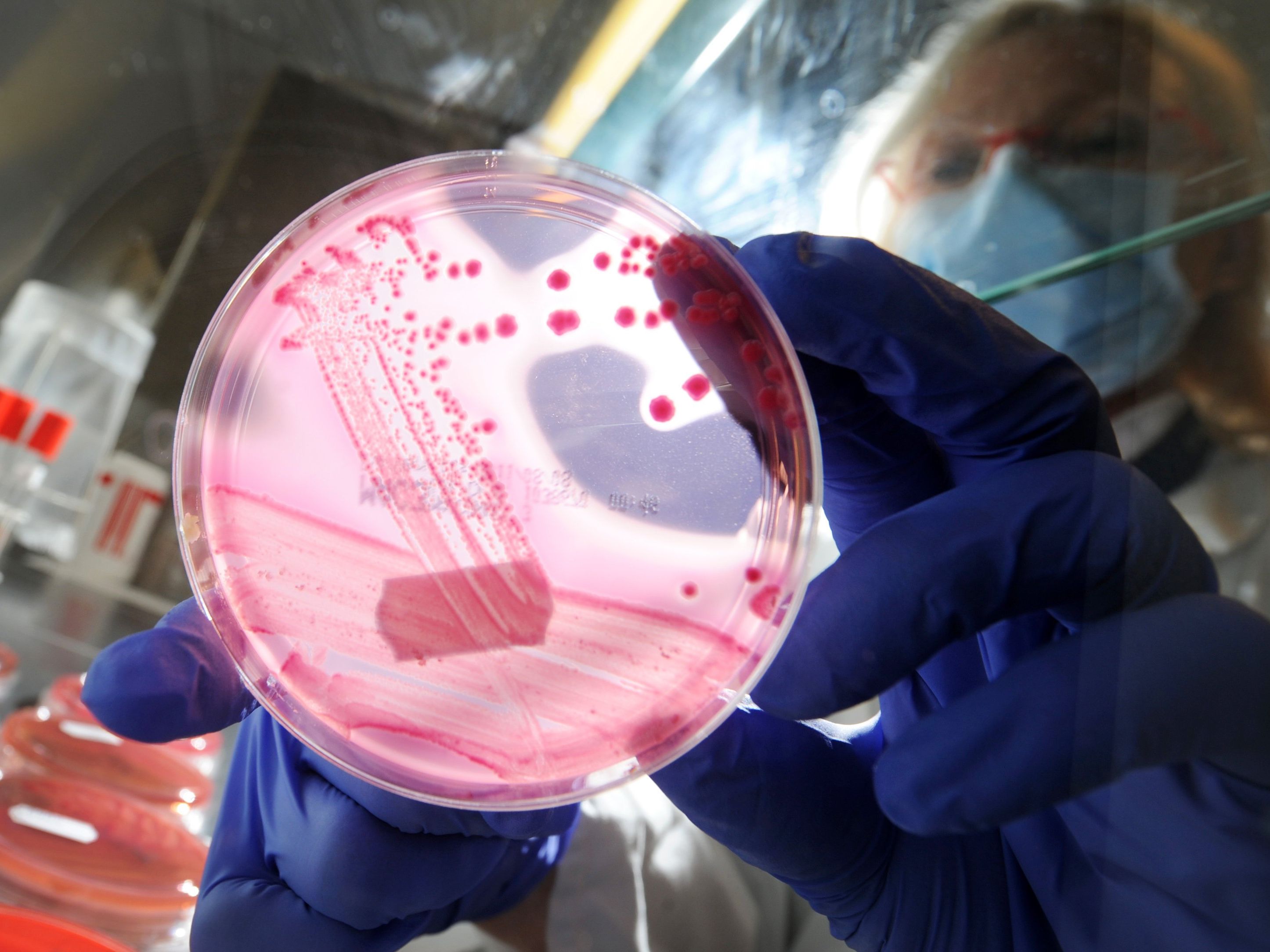 Bakterium mit dem Mcr-1-Gen gegen jedes Antibiotikum resistent. Bakterium mit dem Mcr-1-Gen gegen jedes Antibiotikum resistent.