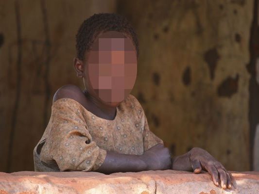 Mann mit Aids-Virus infiziert. Mann mit Aids-Virus infiziert.