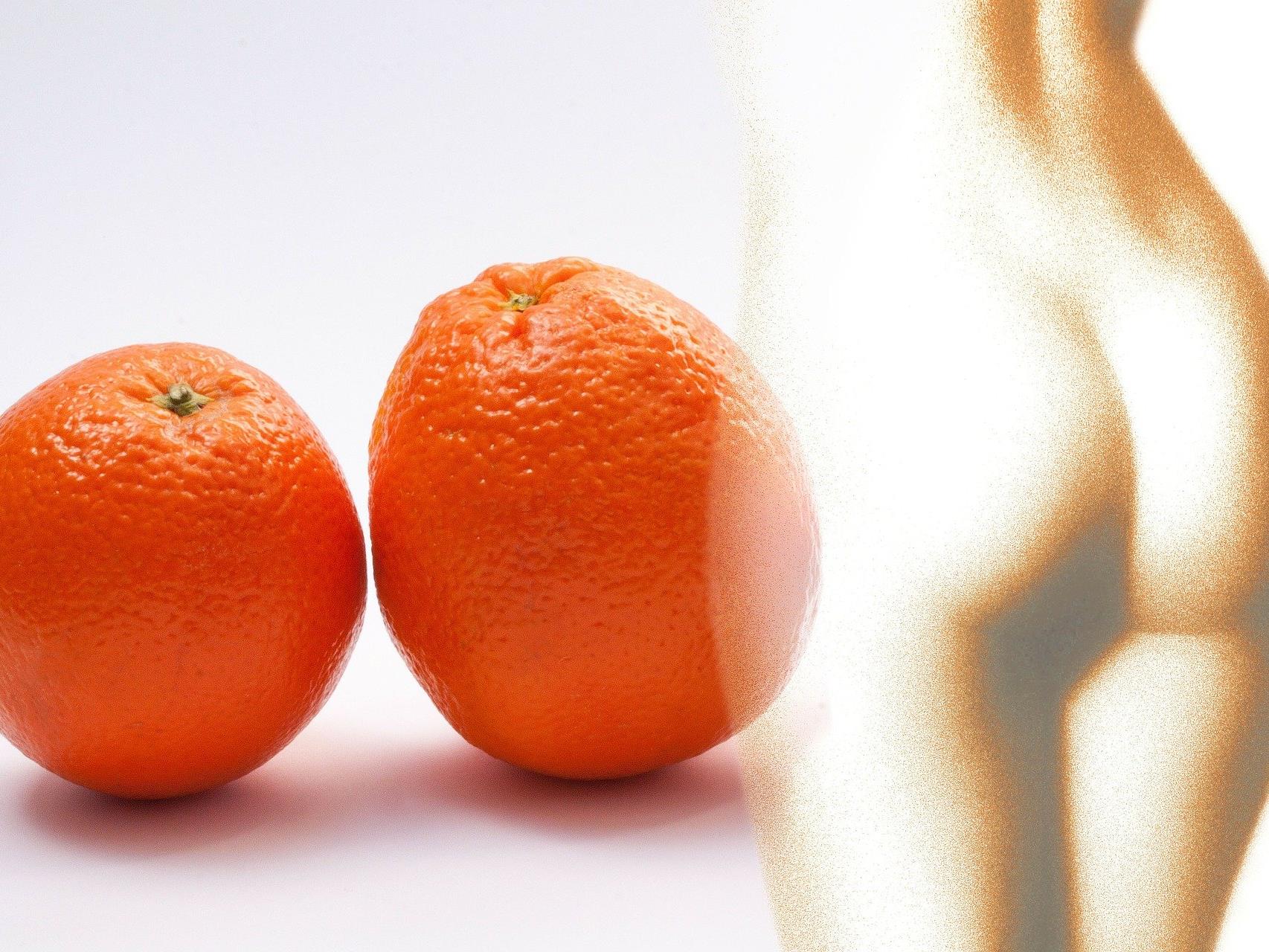 Es werden Produkte für zu Hause angeboten, die gegen Orangenhaut helfen sollen.