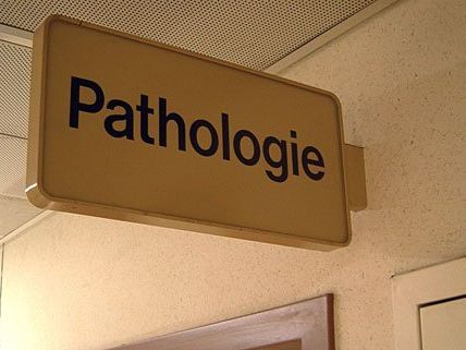 Obduktionsergebnis erwartet: Untersucht wird ein "lagebedingter Erstickungstod Obduktionsergebnis erwartet: Untersucht wird ein "lagebedingter Erstickungstod