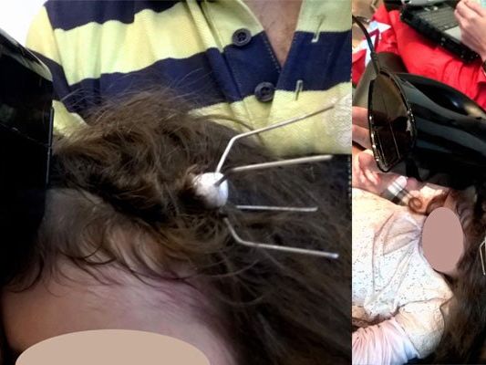 Die Haare der 3-Jährigen verfingen sich im Mixer. Die Haare der 3-Jährigen verfingen sich im Mixer.