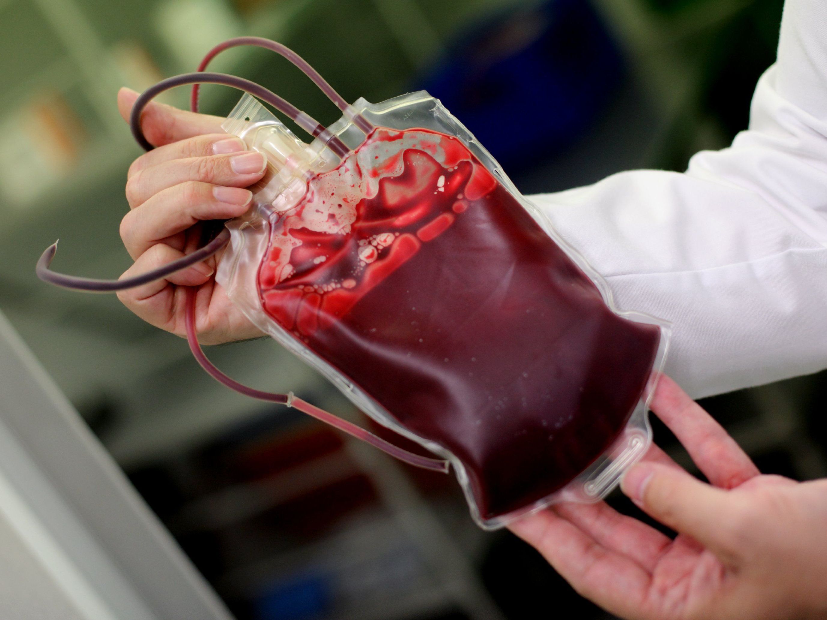 Künstliches Blut könnte bald Realität werden Künstliches Blut könnte bald Realität werden