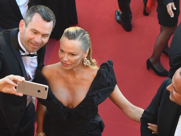 Was ist mit ihrem Gesicht passiert, Frau Anderson? Was ist mit ihrem Gesicht passiert, Frau Anderson?