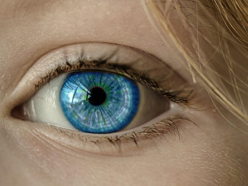 Die Frau sollte operiert werden, als die Ärzte 27 Kontaktlinsen in ihren Augen fanden.
