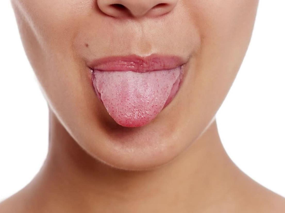 Die Zunge verrät einiges über die eigene Gesundheit.