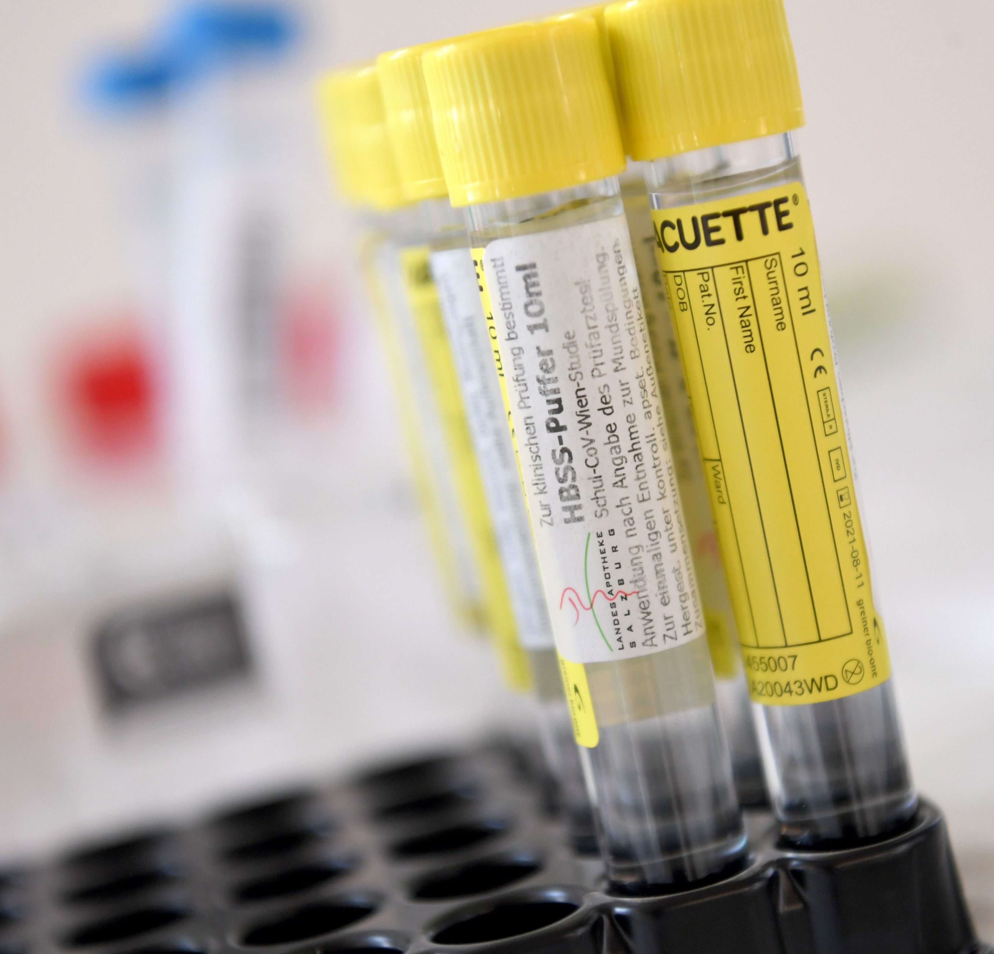 Die "Contact Tracing-Task Force" der AGES wird aktiv, nachdem in Österreich und auch in Wien am Donnerstag Höchstwerte an Infektionen mit dem Coronavirus diagnostiziert worden sind. Die "Contact Tracing-Task Force" der AGES wird aktiv, nachdem in Österreich und auch in Wien am Donnerstag Höchstwerte an Infektionen mit dem Coronavirus diagnostiziert worden sind.